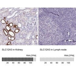 SLC12A3 Antibody, Novus Biologicals 0.1mL; Unlabeled:Antibodies, Polyclonal